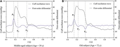 Threshold values of brachial cuff-measured arterial stiffness indices determined by comparisons with the brachial–ankle pulse wave velocity: a cross-sectional study in the Chinese population